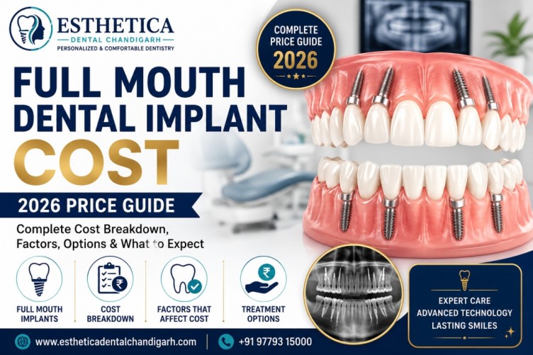 Full mouth dental implant cost
