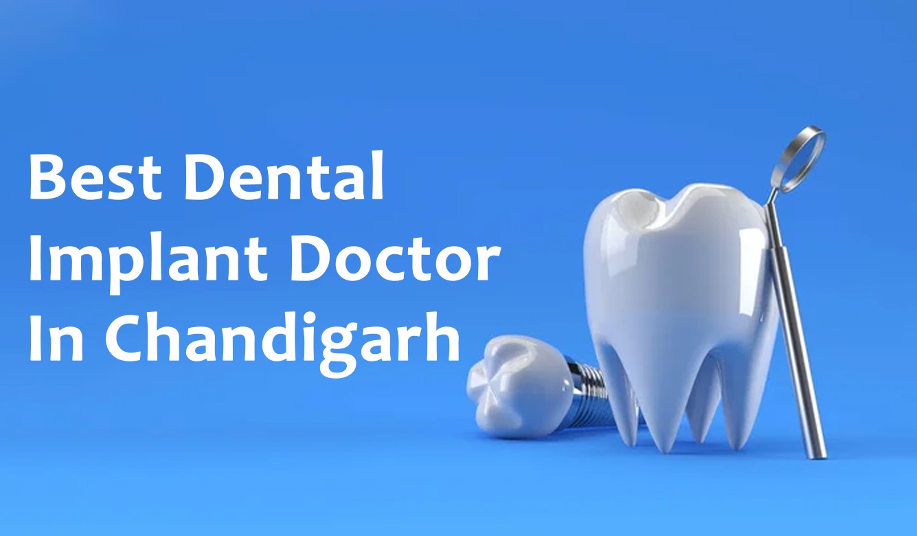 Best dental implant clinic in Chandigarh, Mohali