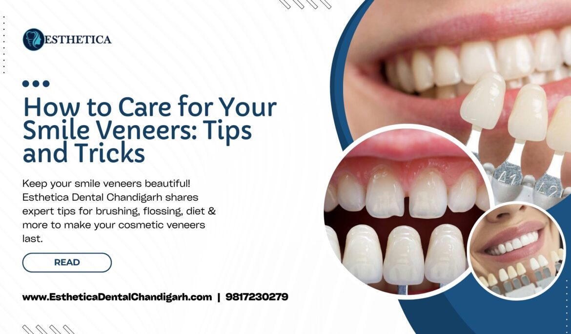How to Care for Your Smile Veneers Tips and Tricks