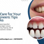 How to Care for Your Smile Veneers Tips and Tricks