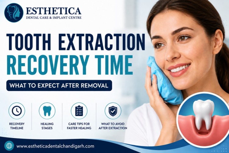 Recovery Time After a Tooth Extraction What to Expect