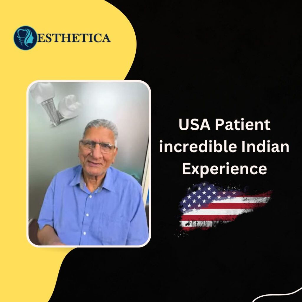 Smile design consultation in India