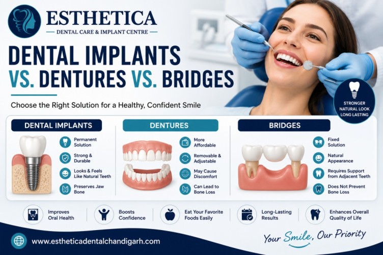 Dental Implants vs. Dentures vs. Bridges