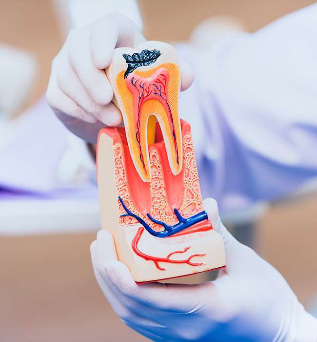 endodontics-1