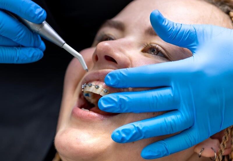 Affordable Braces Chandigarh