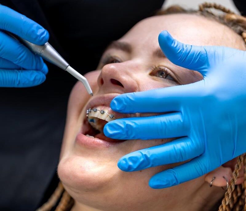 Affordable Braces Chandigarh