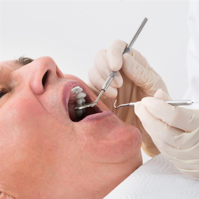 All-on-4 Dental Implants Mohali