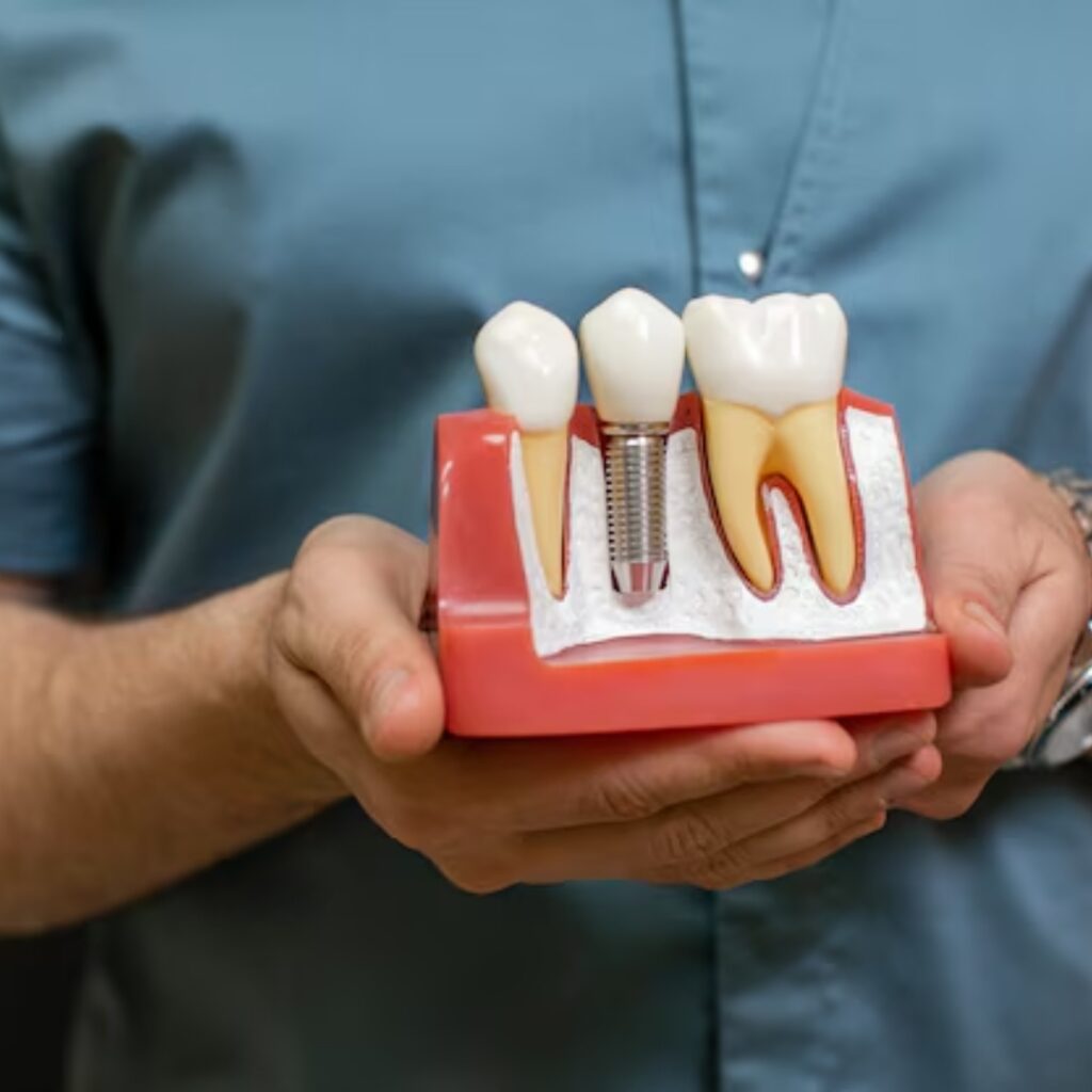 Dental Implants Near Me
