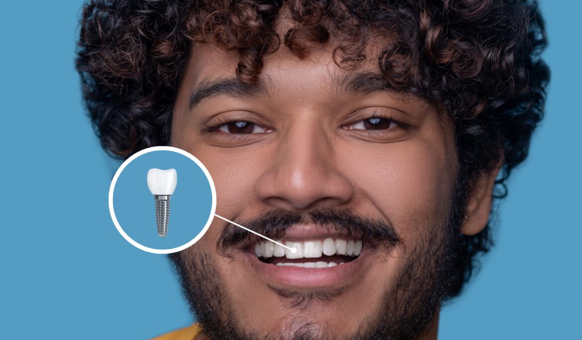 Dental implants abroad