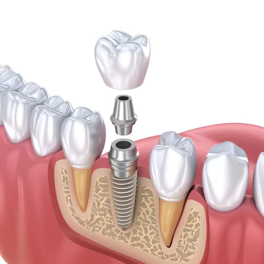 Digital smile makeover treatment