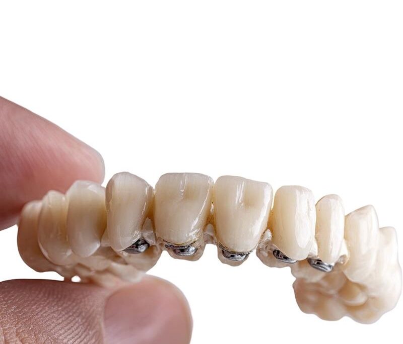 Fixed Teeth in a Day Mohali