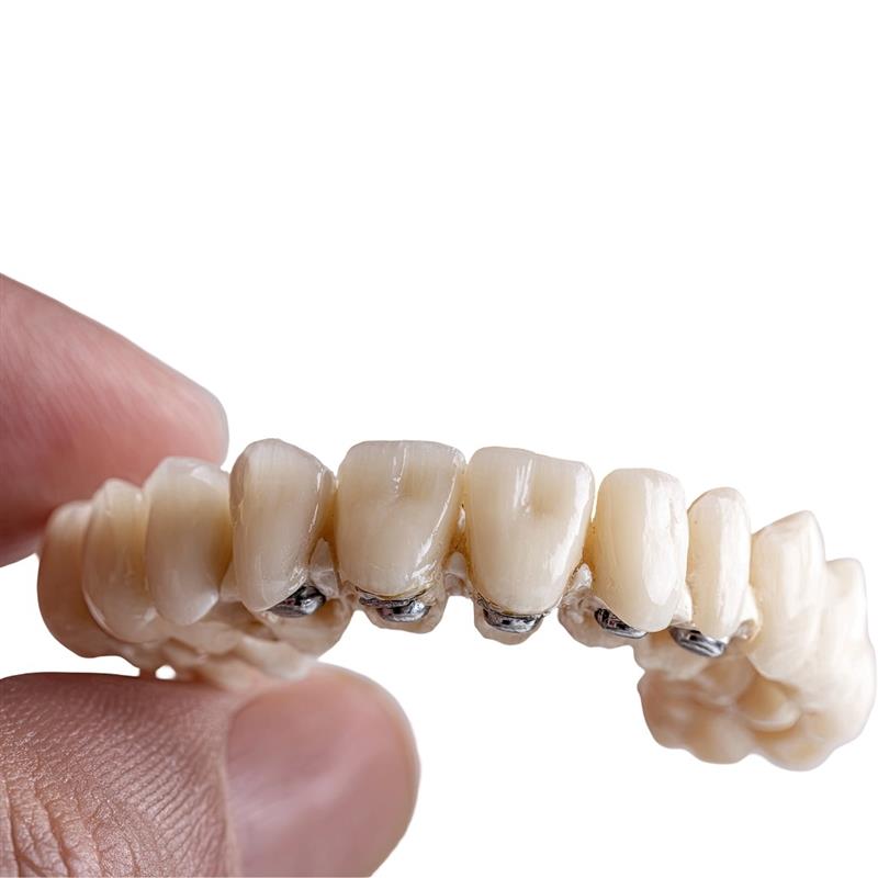 Fixed Teeth in a Day Mohali