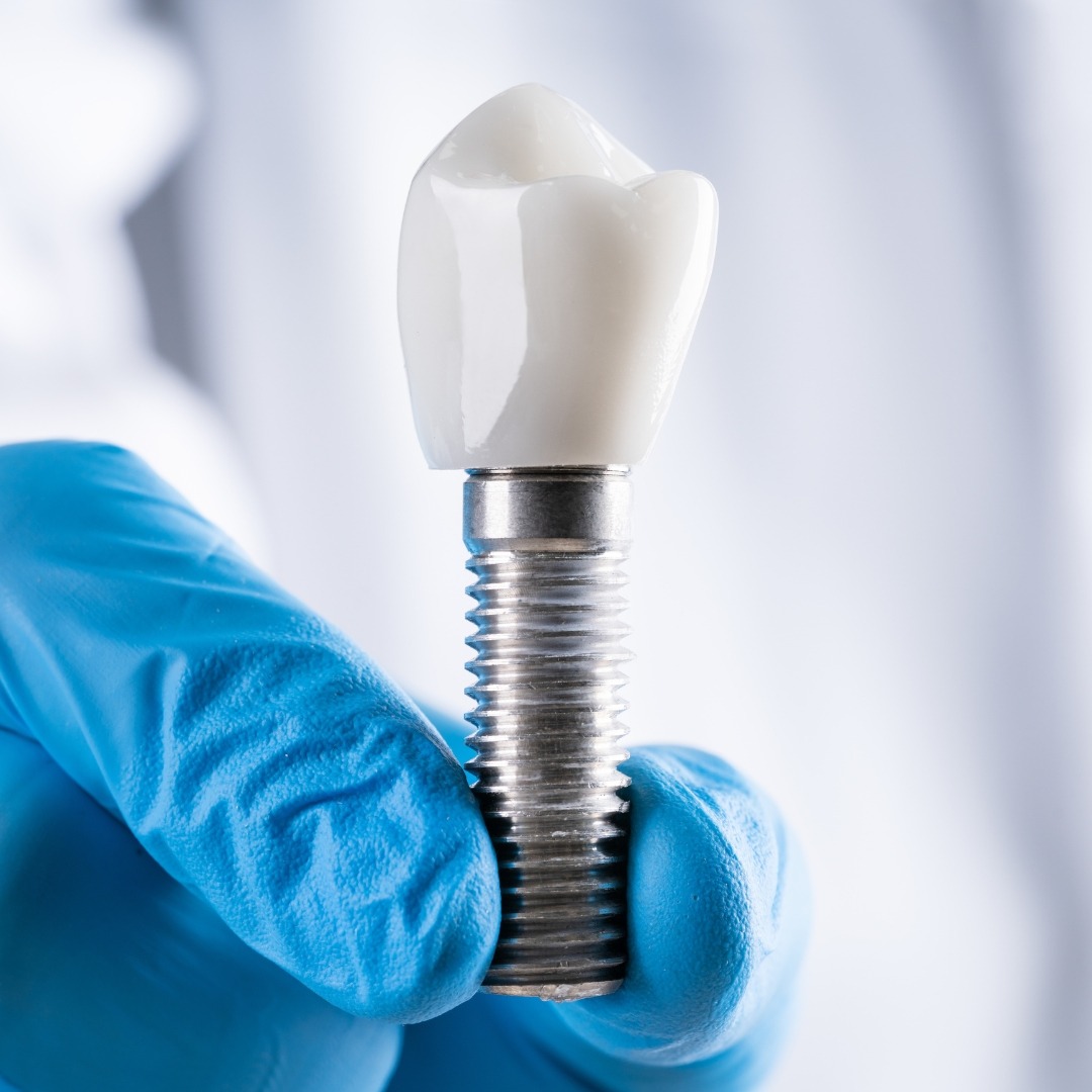 Single dental implant