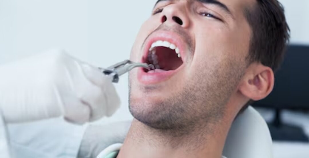 Same Day Tooth Extraction