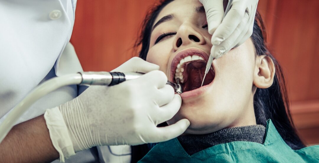 Teeth whitening cost India