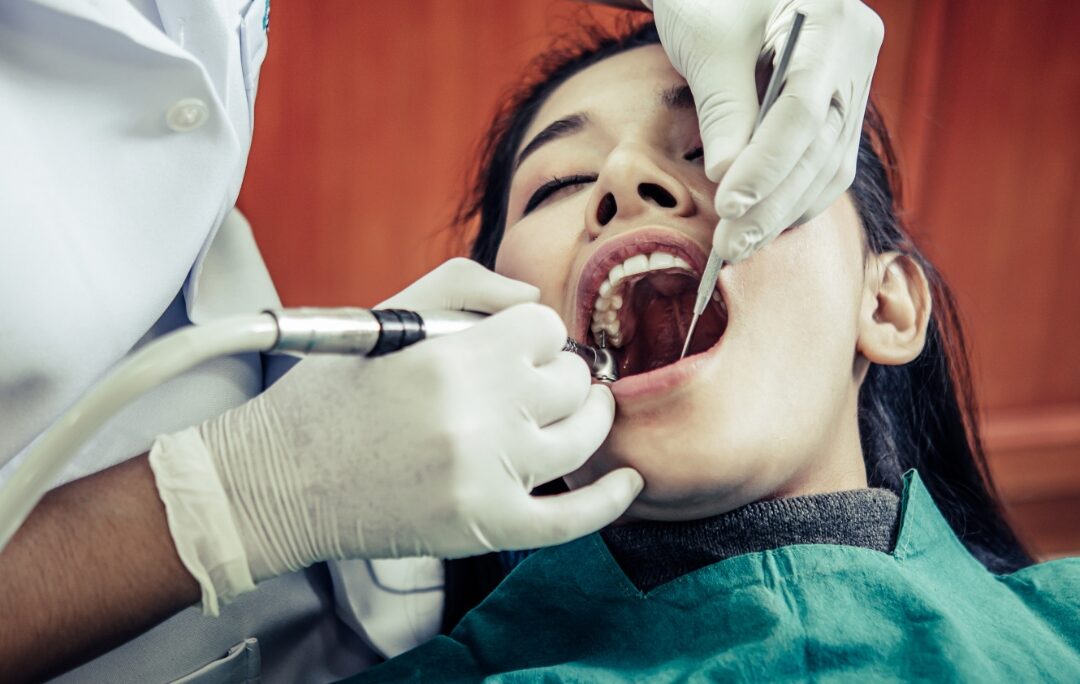 Teeth whitening cost India