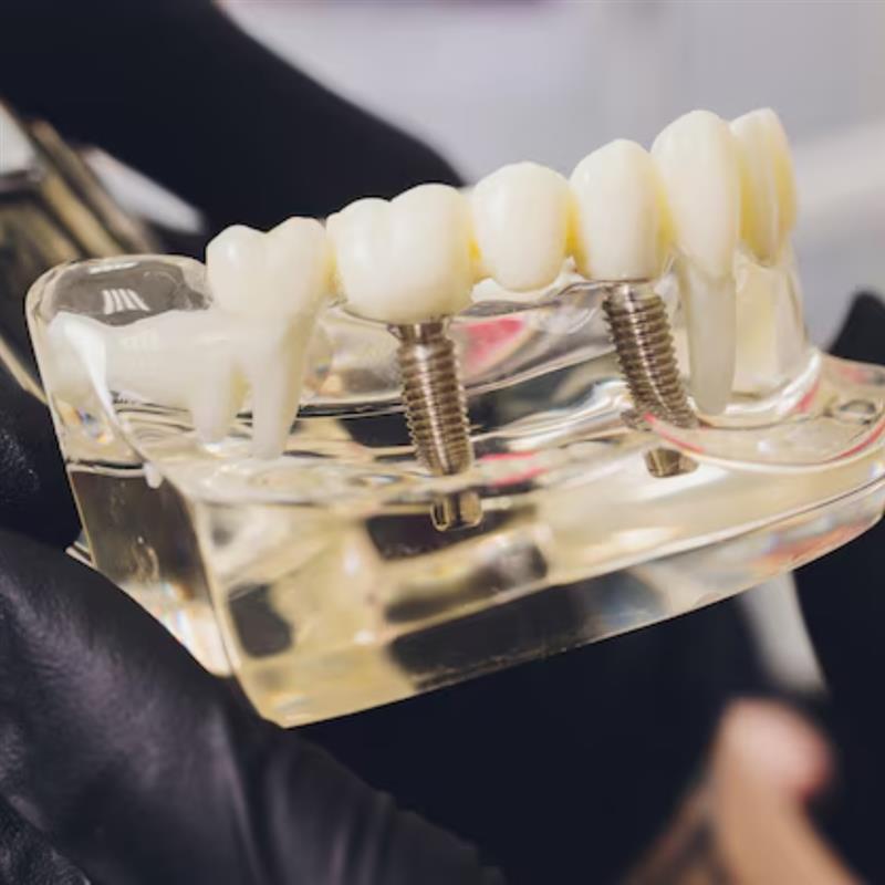 best dental floss for sensitive gums