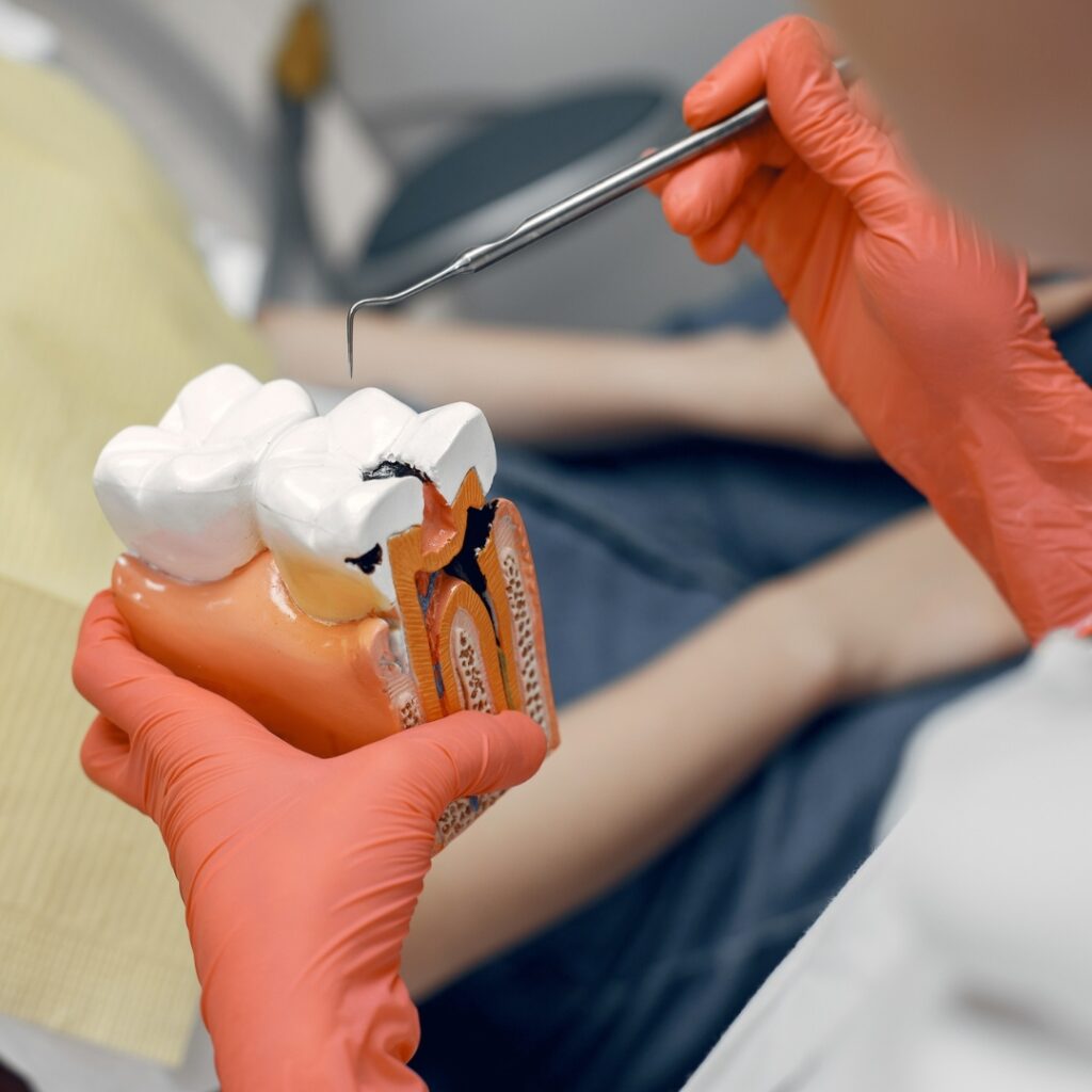 painless root canal treatment in Chandigarh