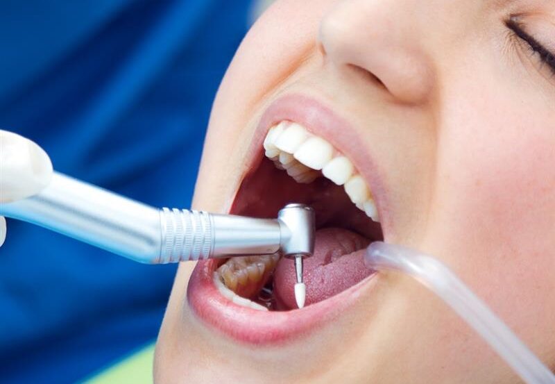 painless root canal treatment near me