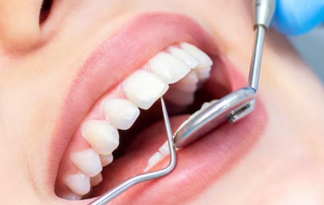 Dental Implants Cost in Chandigarh