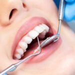Dental Implants Cost in Chandigarh