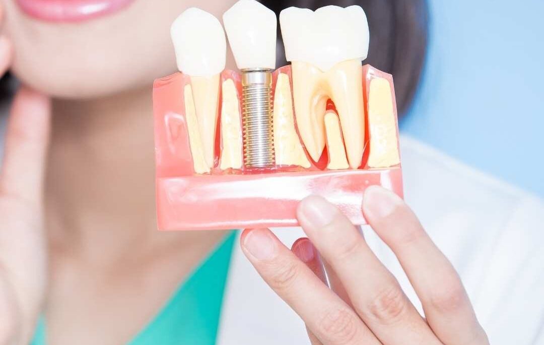 Root Canal Treatment Doctors