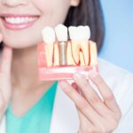 Root Canal Treatment Doctors