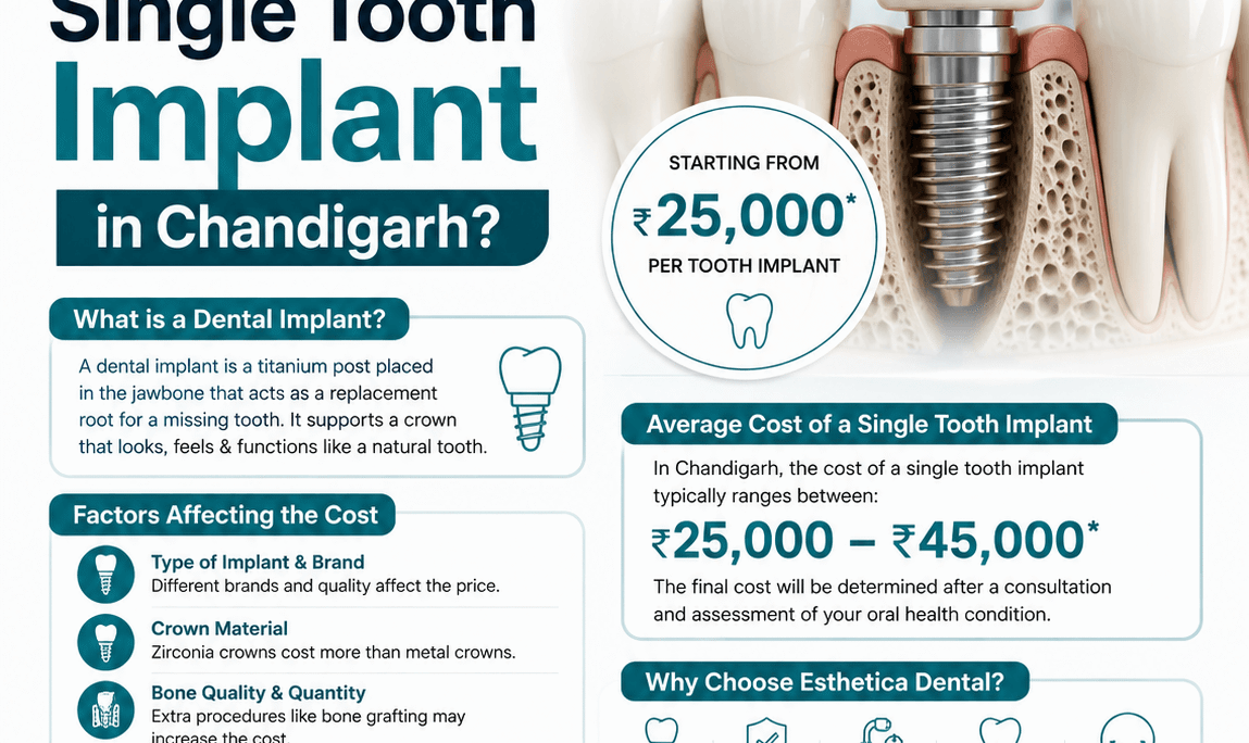 What Is the Cost of a Single Tooth Implant in Chandigarh?