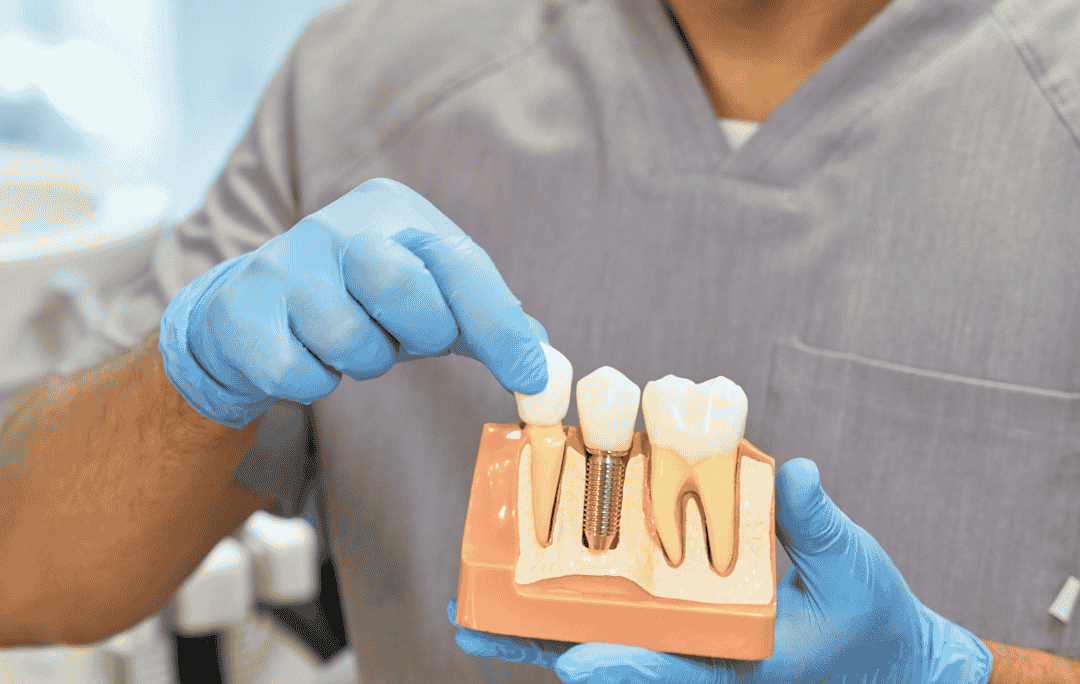dental-implant-training-certification-course