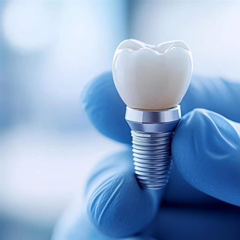 smile designers Chandigarh