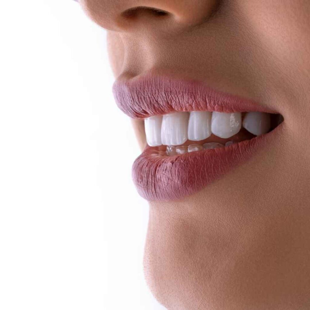 Best laser teeth whitening clinic Chandigarh