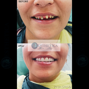 Esthetica Dental Clinic | Dental Implant | Dental Academy Mohali, India place picture
