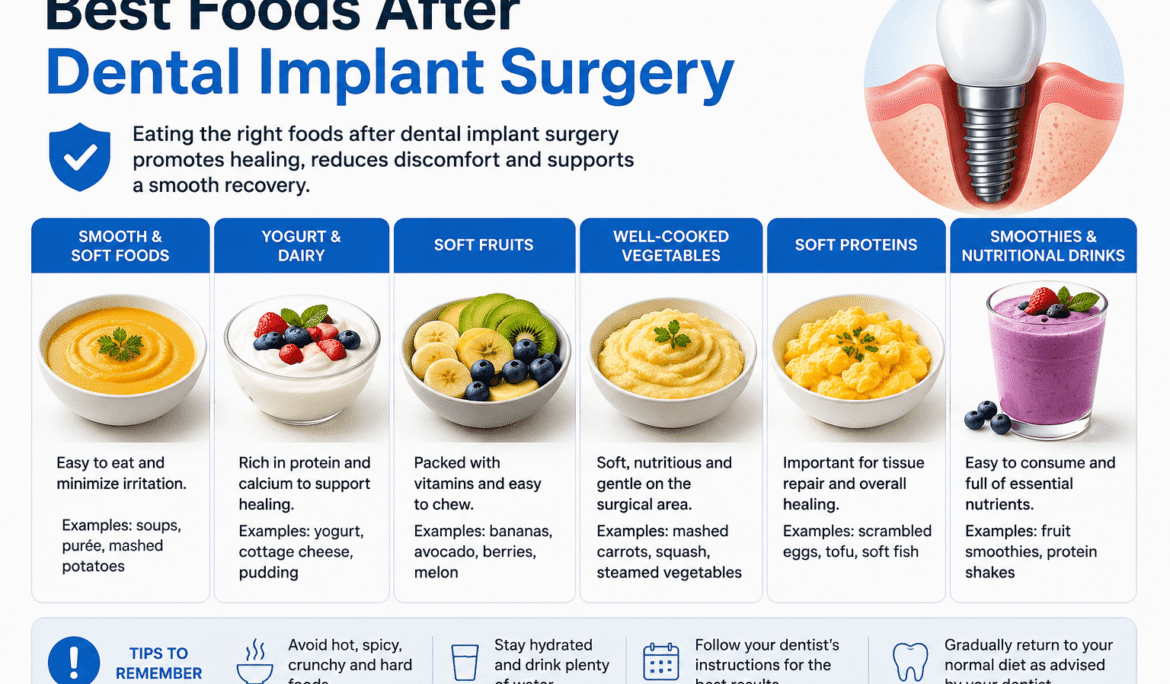 Best Foods After Dental Implant Surgery