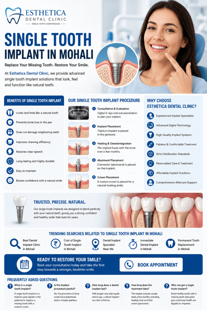 single implant mohali