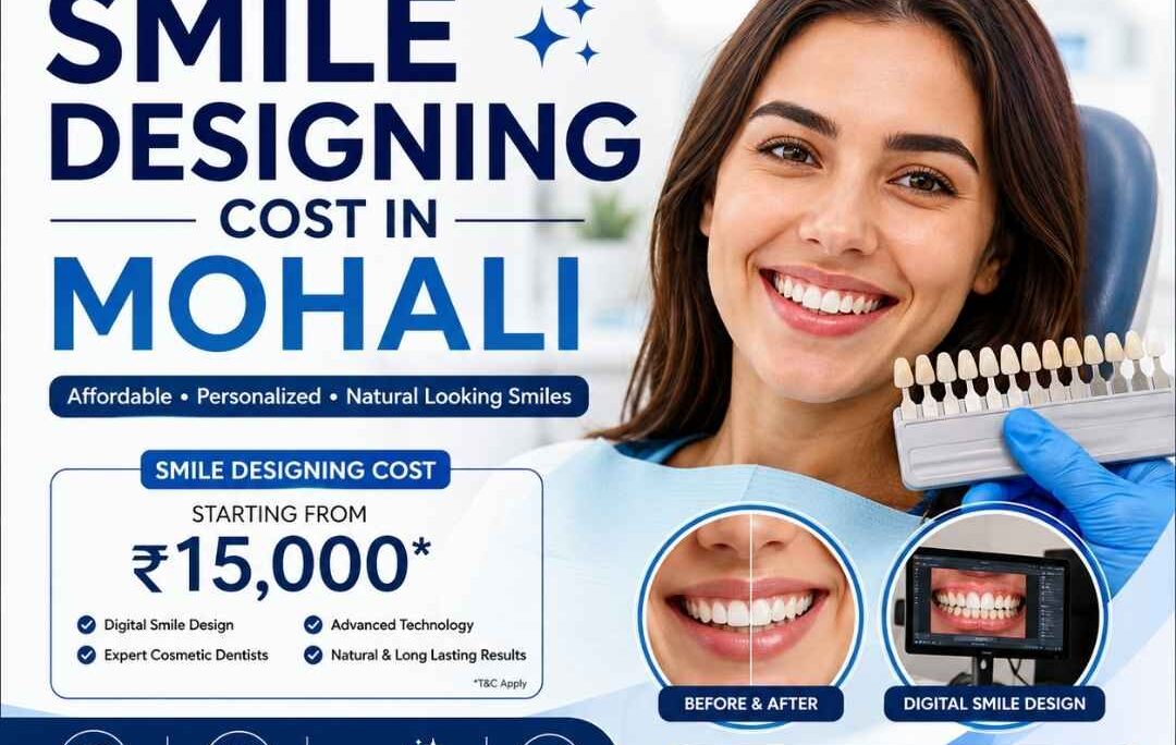 Smile Designing Cost in Mohali