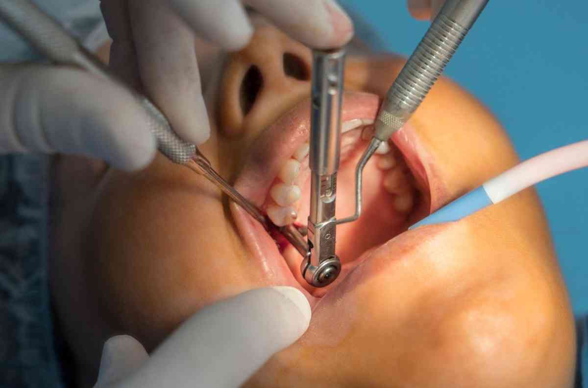 Dental implant consultation