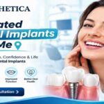 top rated dental implants near me