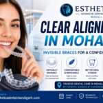 Clear Aligners in Mohali for a Straighter and Confident Smile