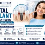 Dental Implants for Missing Teeth