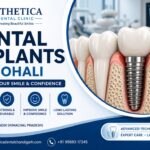 Dental Implants in Mohali