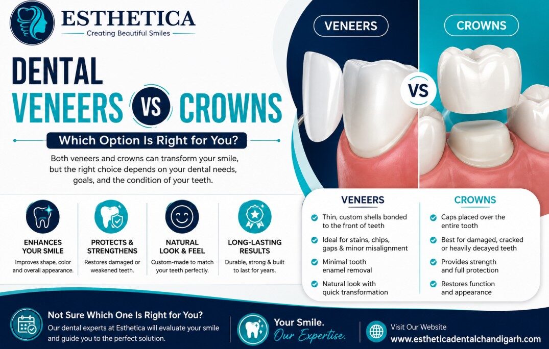 Dental Veneers vs Crowns