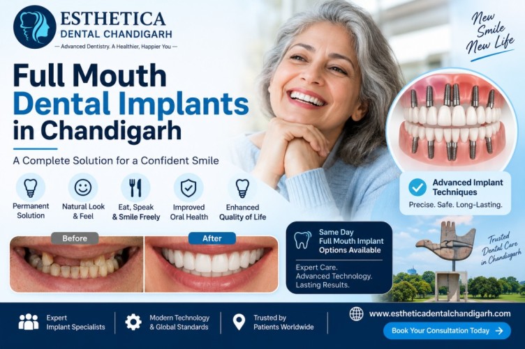 Full Mouth Dental Implants in Chandigarh