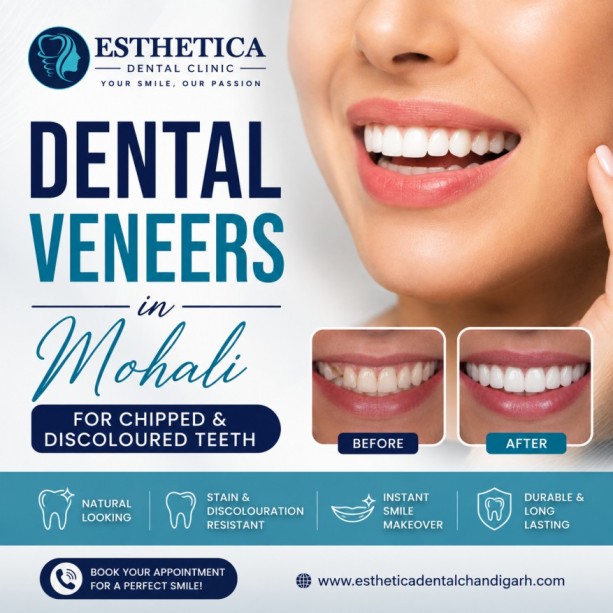 How Can Dental Veneers Correct Chipped and Discoloured Teeth