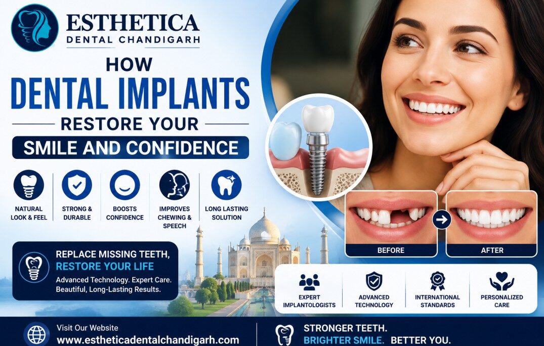 How Dental Implants Restore Your Smile and Confidence