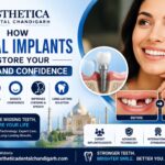 How Dental Implants Restore Your Smile and Confidence