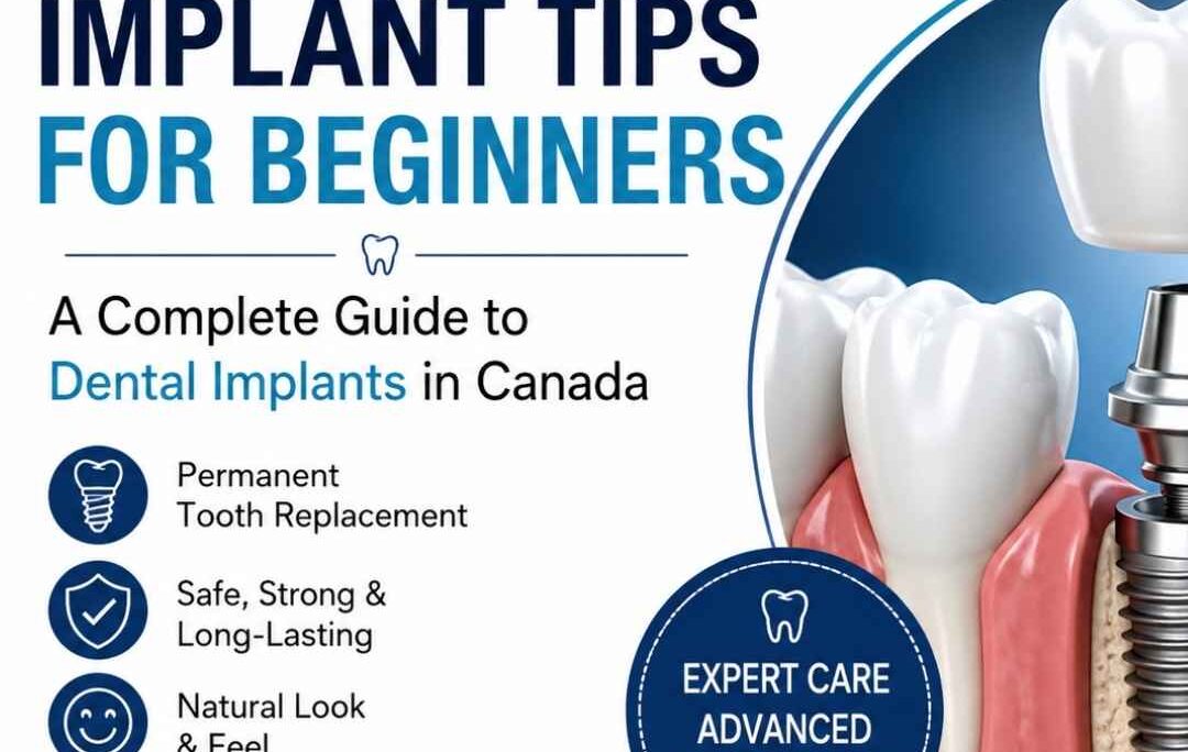 Implant Tips for Beginners
