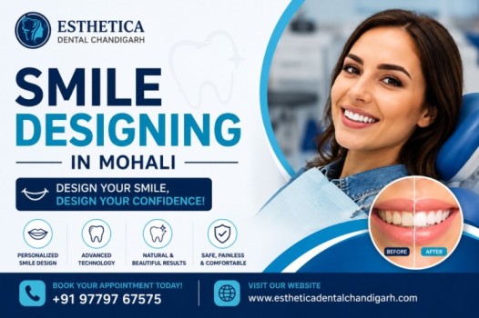 Smile Design Treatment in Mohali