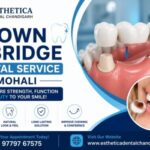 crown and bridge dental service in Mohali