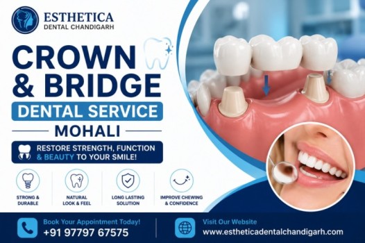 crown and bridge dental service in Mohali