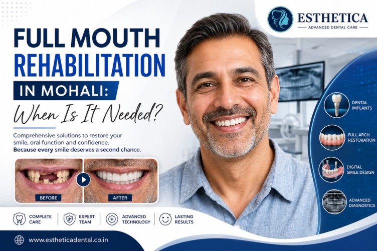 full mouth rehabilitation in Mohali